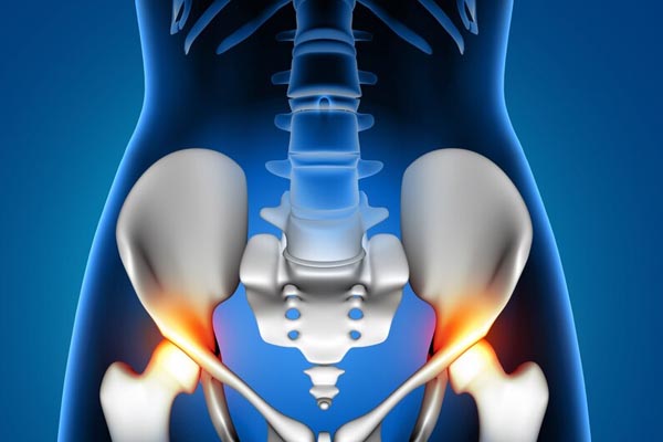 Kalça Protezi Ameliyatı Sonrası İyileşme Süreci